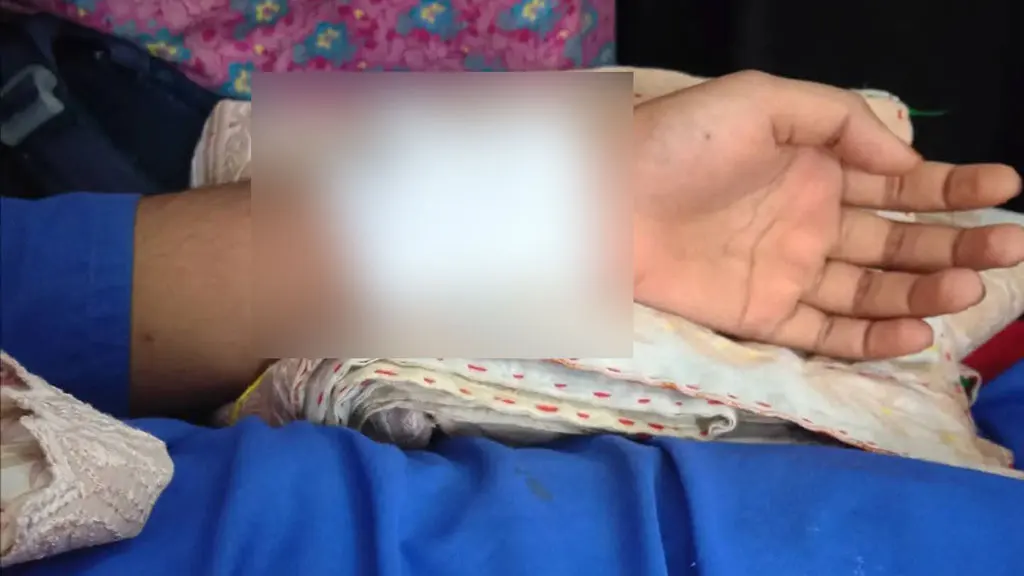 স্কুলে যাওয়ার পথে ছাত্রীকে জখম করে অলঙ্কার ছিনতাই