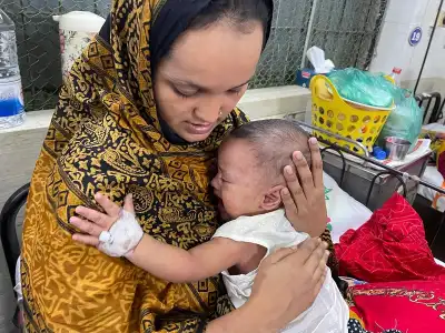 শিশু হাসপাতালে বাড়ছে হাম ও নিউমোনিয়ায় আক্রান্ত রোগীর ভিড়